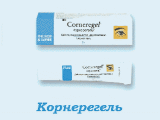 Корнерегель