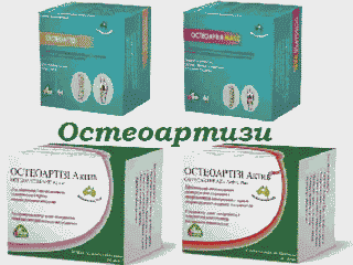 Остеоартизи